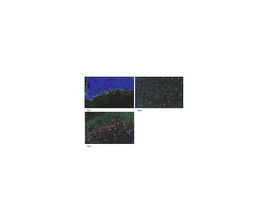 62-8472-72 Anti-CELSR1; 100 μg ABT119