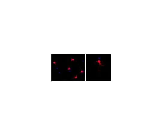 62-8494-84 Anti-MAP2, clone AP20, Alexa Fluor(R) 555 Conjugate; 100 μL MAB3418A5