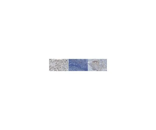 62-8524-64 Anti-asparagine synthetase Antibody, clone Z5808 MABS1300