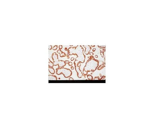 62-8490-34 Anti-Insulin-like Growth Factor-I Receptor, alpha-Subunit, clone 24-31; 100 μg MAB1120
