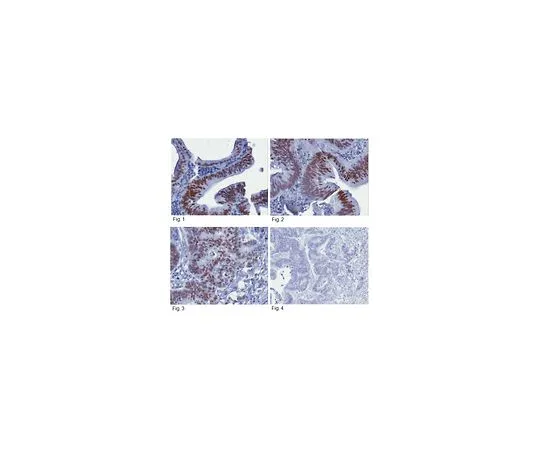 62-8505-45 Anti-JMJD2A, clone 8B7.1 MABE222