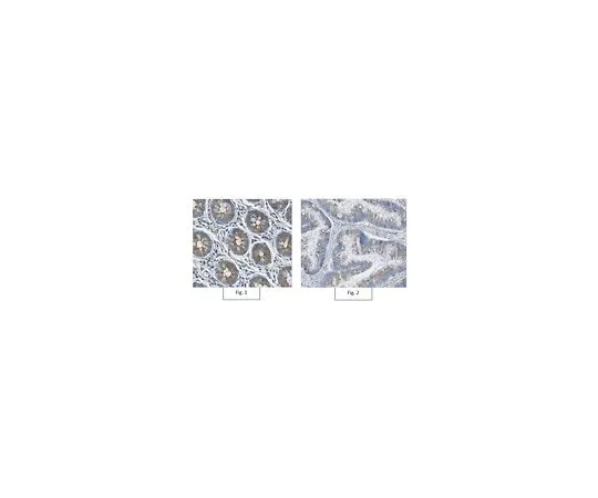 62-8502-62 Anti-TNFα Receptor Antibody, clone 13F9.1 MABC615