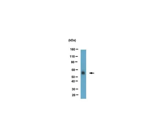 62-8471-16 Anti-ACAT-2 Antibody ABS988