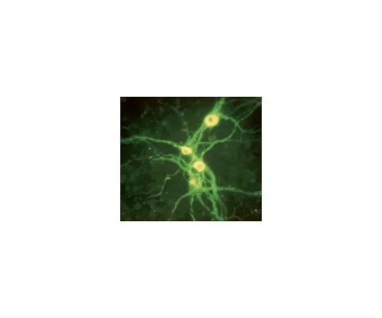 62-8488-58 Anti-Tyrosine Hydroxylase Antibody, clone LNC1, Alexa Fluor(R) 555 Conjugate MAB318-AF555