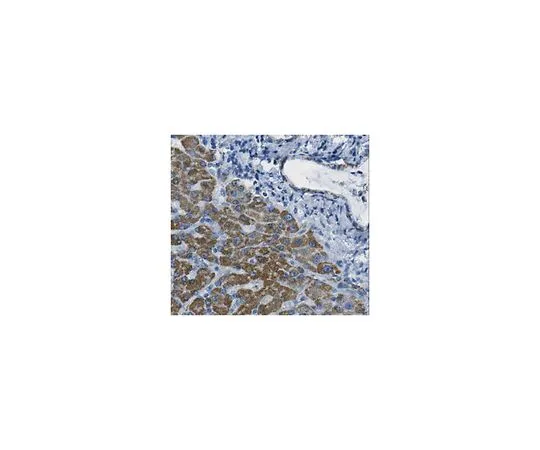 62-8525-92 Anti-CLPP, clone 6G7.3 MABT183