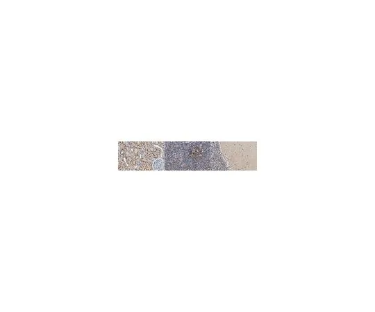 62-8503-72 Anti-LMO-2 (Rhombotin-2) Antibody, clone 1A9-3B11 MABC1144