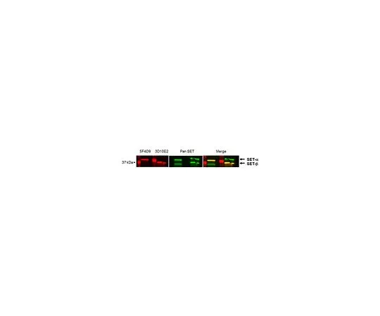 62-8521-59 Anti-SET-alpha, clone 5F4D9 MABN1863