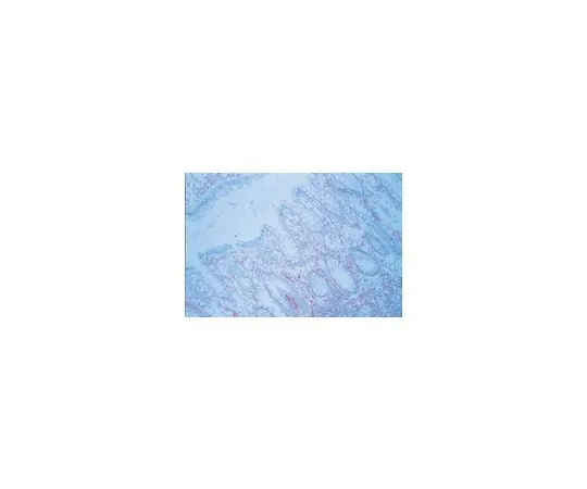 62-8493-28 Anti-ICAM-1, clone P2A4; 100 μg MAB2146