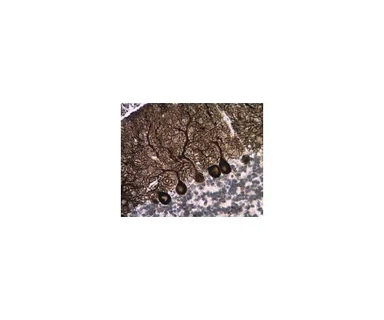 62-8469-15 Anti-InsP3R, Type 1; 100 μg ABS55