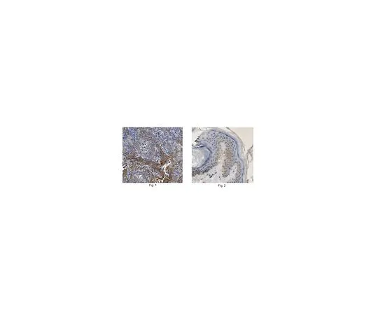 62-8526-25 Anti-Desmoglein-3, clone 5G11 MABT335