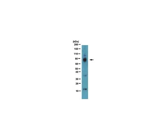 62-8469-39 Anti-AKAP 79; 100 μg ABS102