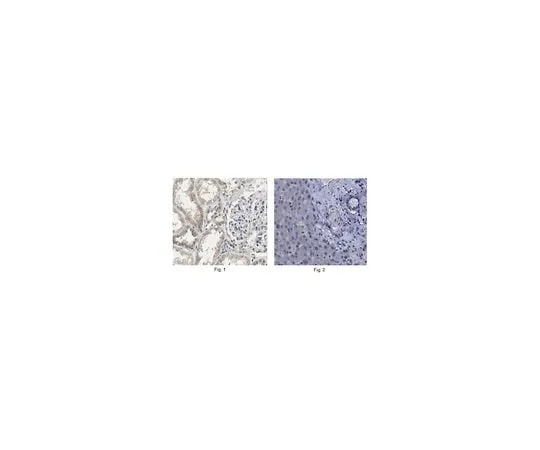 62-8470-35 Anti-LARS ABS487