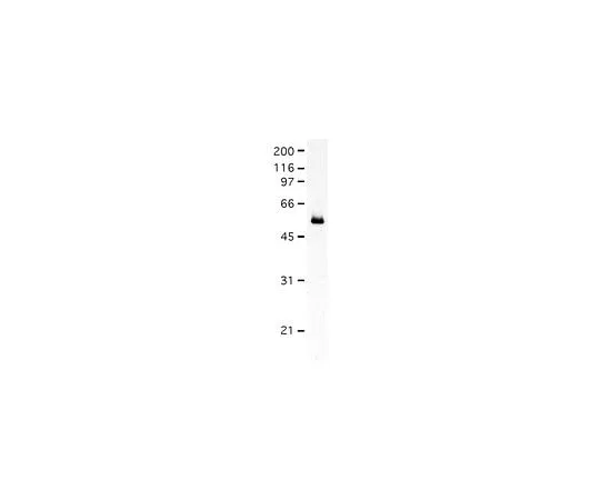 62-8495-33 Anti-Fascin, clone 55K2; 100 μg MAB3582
