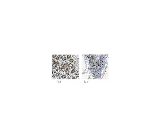 62-8506-50 Anti-CHD-4 Antibody, clone 3F2/4 Cat. No. MABE455 MABE455