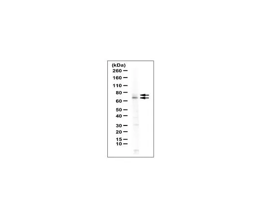 62-8471-28 Anti-MTHFR Antibody ABS1013