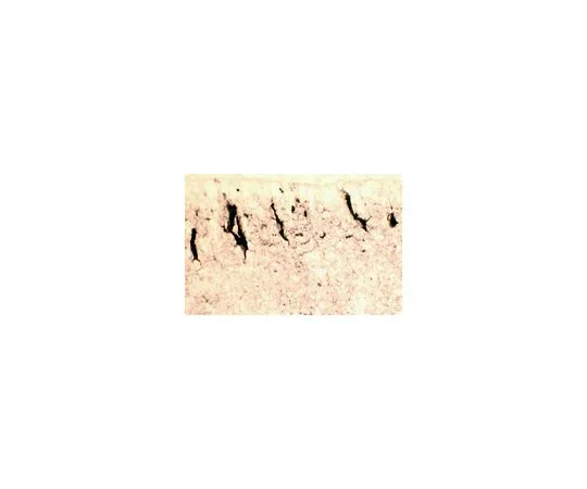 62-8497-70 Anti-Reelin, a.a. 164-189 mreelin, clone 142; 100 μg MAB5366