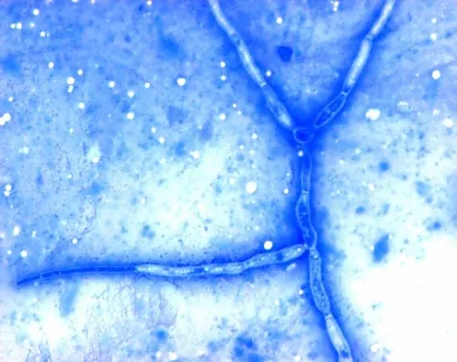 61-0320-93 Chromolith(R) Semiprep Si 100-10 mm 152015 1ST 1.52015.0001