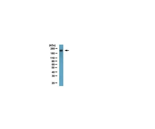 62-8525-12 Anti-ZO-1, clone R40.76; 100 μg MABT11