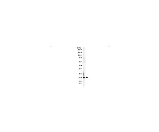 62-8472-05 Anti-VPS25 ABS1676
