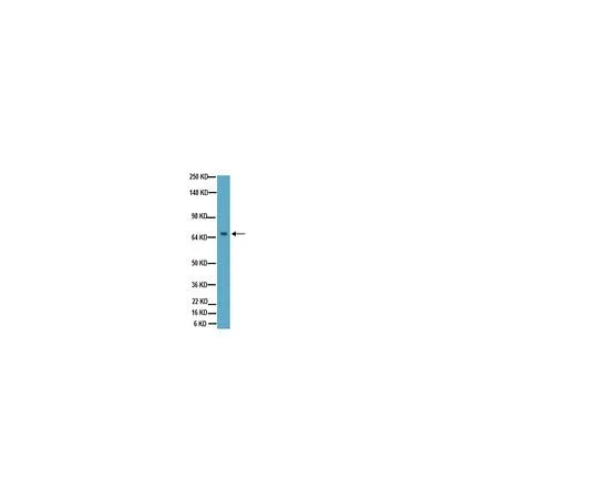 62-8489-06 Anti-Tau, a.a. 210-241, clone Tau-5; 100 μL MAB361