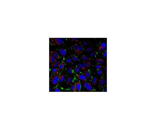 62-8474-10 Anti-alpha-Actin Antibody, Smooth Muscle ABT1487