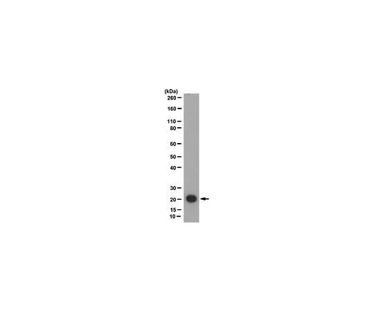 62-8472-42 Anti-Claudin-7; 100 μg ABT47