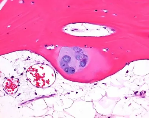 61-0290-53 OSTEOMOLL(R) Rapid Decalcifier Solution for Histology 101736 1L 1.01736.1000