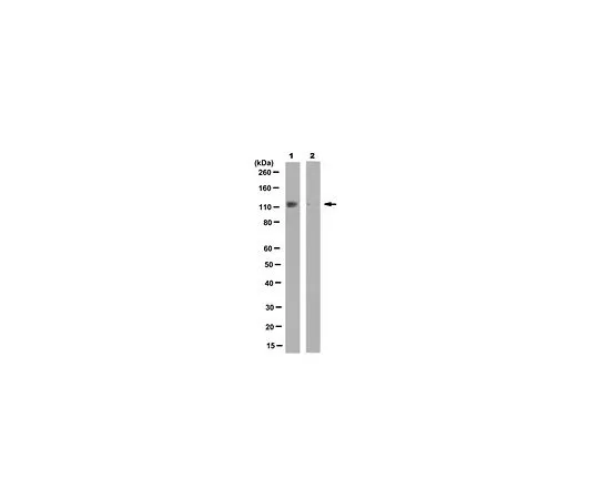 62-8502-01 Anti-phospho-ULK1 (Ser 467), clone 15D12.3 MABC307 MABC307