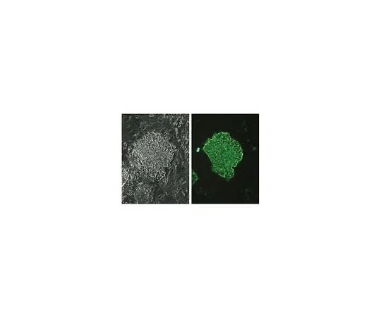 62-8496-32 Anti-Stage-Specific Embryonic Antigen-4, clone MC-813-70; 100 μg MAB4304
