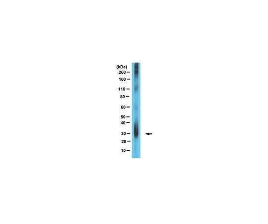 62-8471-37 Anti-Apolipoprotein D ABS1030