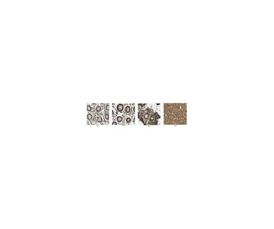62-8526-01 Anti-Connexin-26, clone 3B12.1 MABT198