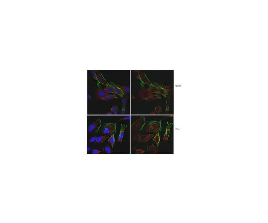 62-8472-65 Anti-SDHD (CybS) ABT110