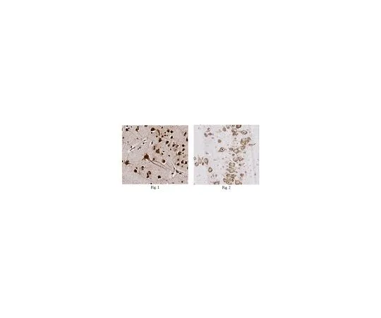 62-8516-93 Anti-HuC/HuD Antibody, clone 15A7.1, Cat. No. MABN153 MABN153
