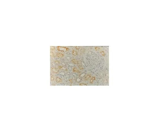 62-8496-04 Anti-MDR1, clone JSB-1; 100 μg MAB4120