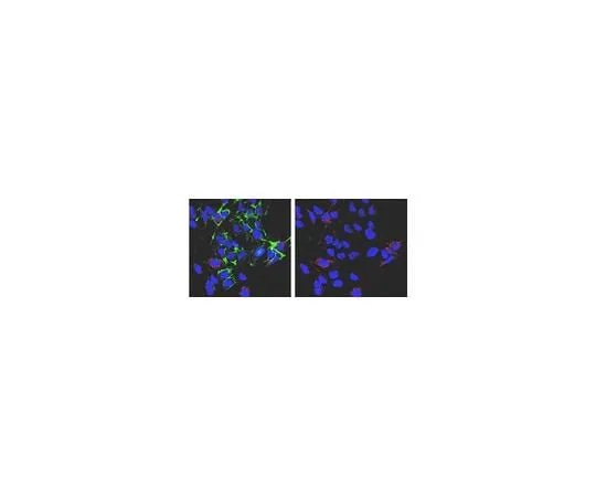 62-8469-63 Anti-phospho-PDHE1-A type I (Ser293); 50 μL ABS204