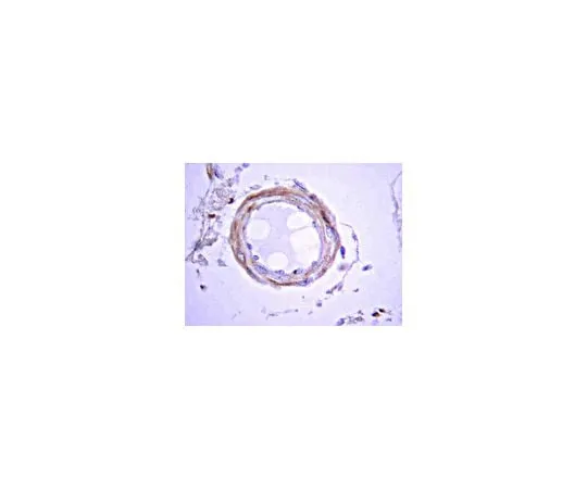62-8488-88 Anti-Alzheimer Precursor Protein A4, a.a. 66-81 of APP (N-terminus), clone 22C11; 100 μL MAB348-100UL