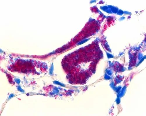61-0314-70 Tb-Color Cold-Type Acid-Fast Bacteria Stain Set 116450 1Set 1.16450.0001
