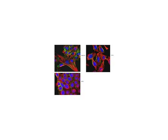 62-8526-06 Anti-α-Tubulin, clone DM1A MABT205