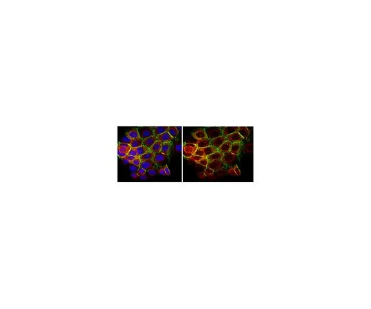62-8521-98 Anti-phospho-p70 S6 Kinase (Thr389) MABS82