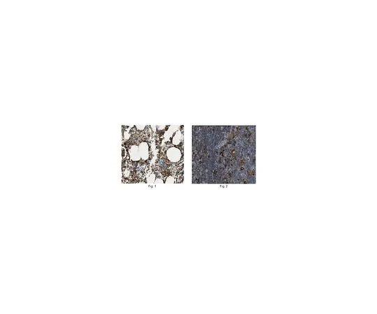 62-8502-53 Anti-Ferritin Heavy Chain, clone 1-2.3.1.2 MABC602