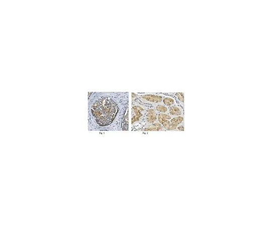 62-8502-76 Anti-AMACR, clone 2A10F3 MABC677