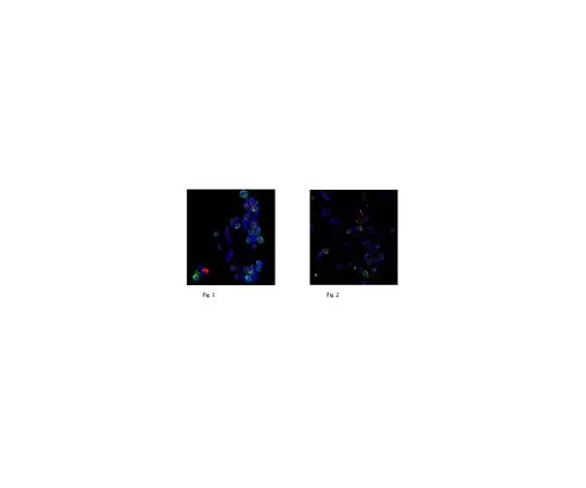 62-8522-69 Anti-Neutrophil Elastase, clone AHN-10 MABS461