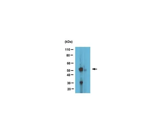62-8473-09 Anti-alpha Tubulin Antibody, tyrosinated Cat. No. ABT171 ABT171