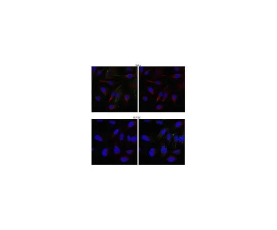 62-8472-94 Anti-Kinesin-like protein KIFC3 ABT151