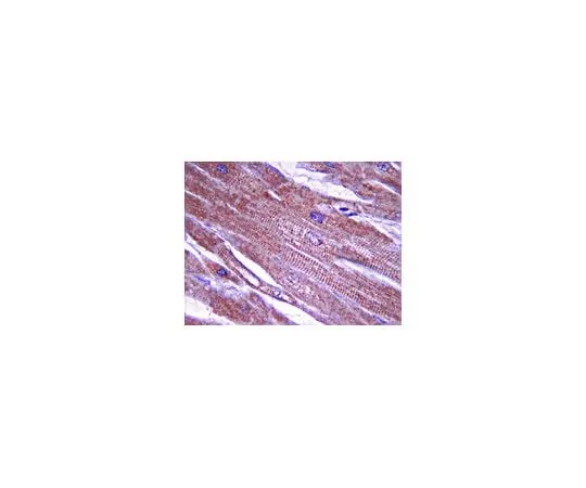 62-8493-58 Anti-Tropomyosin, clone 15D12.2; 100 μg MAB2254