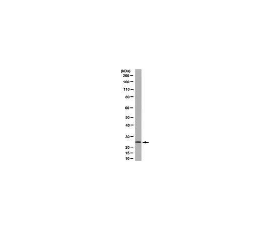 62-8502-59 Anti-Thymidylate Kinase/TMPK Antibody, clone 1A5.1 MABC609