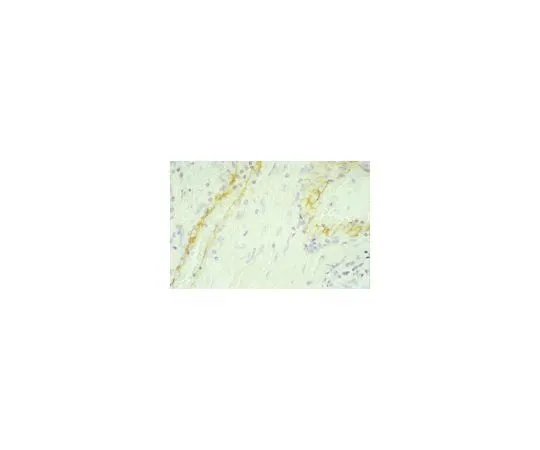 62-8479-80 Anti-PECAM-1, domains 3-6 of human PECAM-1, clone HC1/6; 100 μg CBL468
