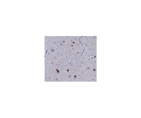 62-8516-74 Anti-ARX MABN102