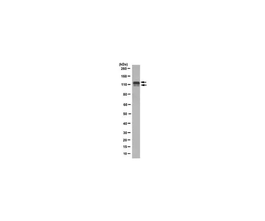 62-8526-14 Anti-DDR2 Antibody, clone 2B12.1 MABT322
