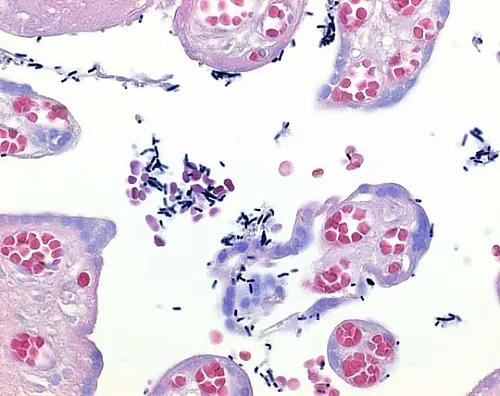 61-0287-17 Lugol Solution PVP Added As A Stabilizer for Gram Staining 100567 1L 1.00567.1000